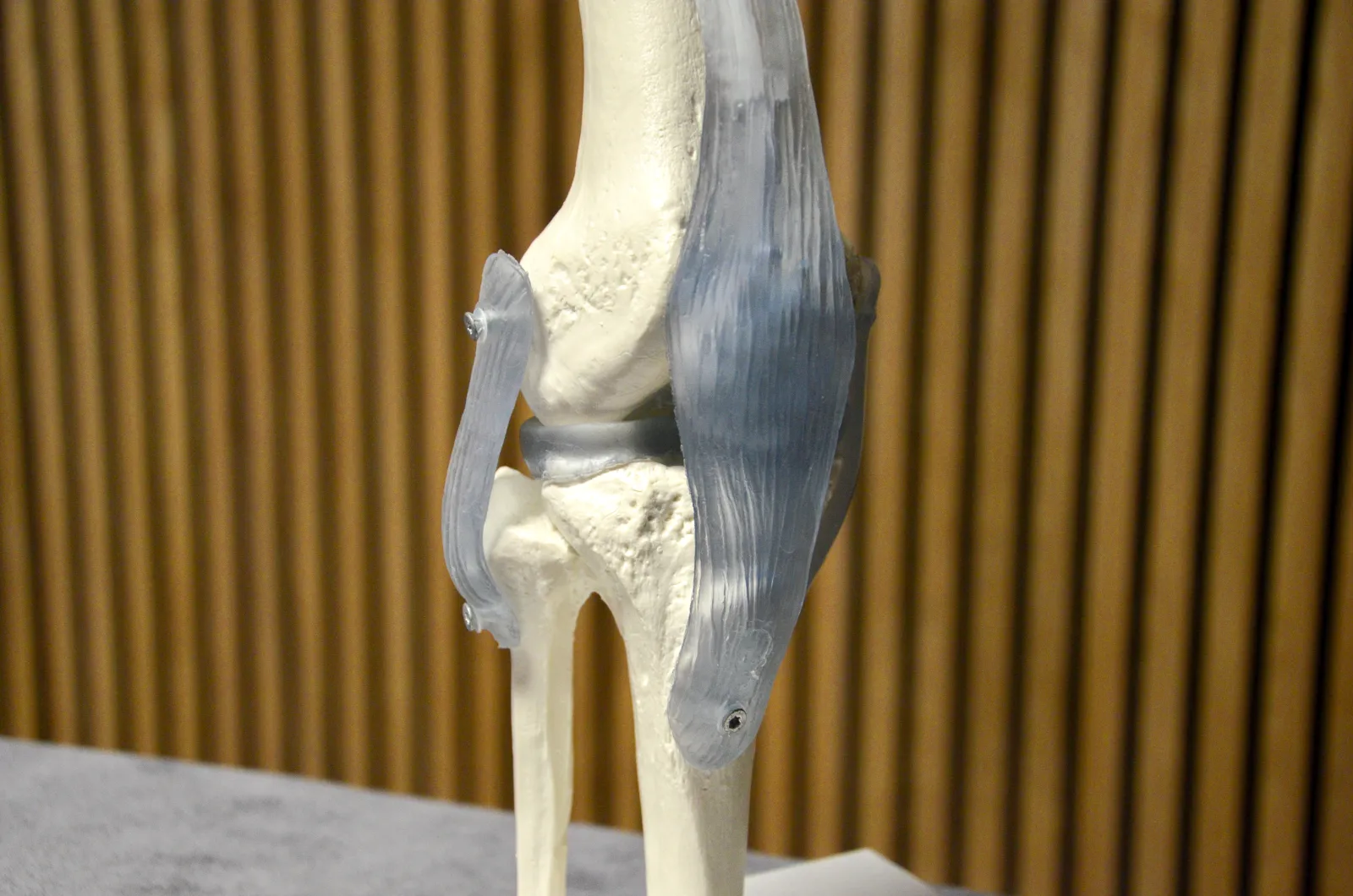 Anatomisch model van het kniegewricht met banden en meniscus